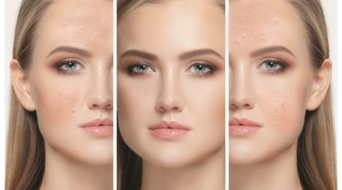 Woman before and after treatment